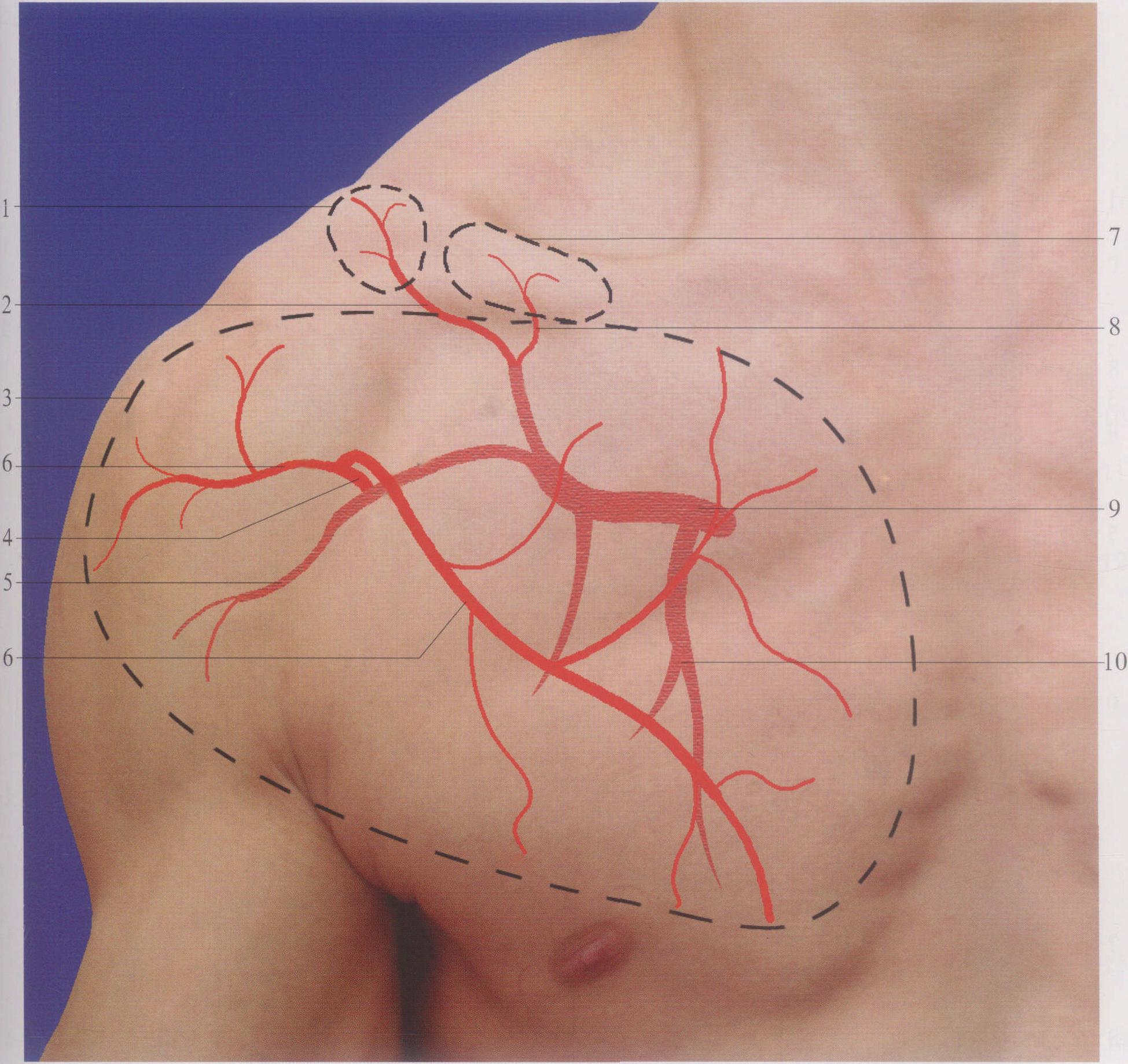 二、胸肩前部血管体表投影及组织瓣设计